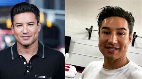 mario adrion|Holy Shit! What did Mario Lopez do to his face